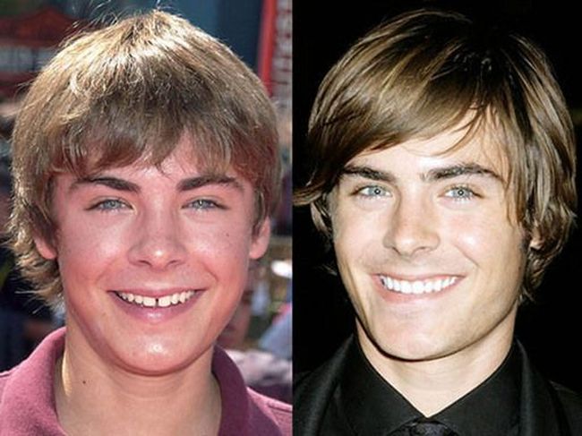 Звездные улыбки: до и после (10 фото)