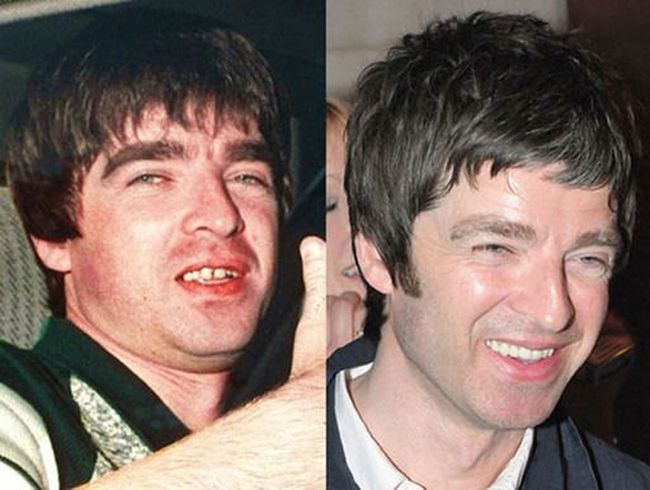 Звездные улыбки: до и после (10 фото)
