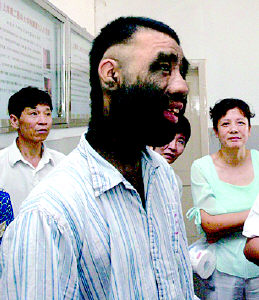 Самый волосатый человек в Китае (5 фото)