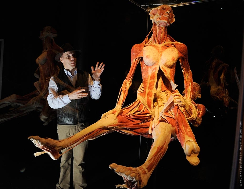 23.06.2009, Лондон | Скандально известный немецкий анатомист Гюнтер фон Хагенс показывает экспонат своей новой выставки «Body Worlds».
