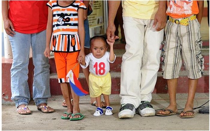 Самый низкий человек в мире Джунри Балауинг (12 фото)