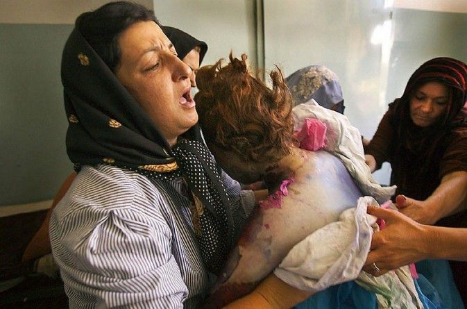 Самосожжение афганских женщин (18 фото)