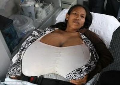 Женщины с огромной грудью (25 фото)