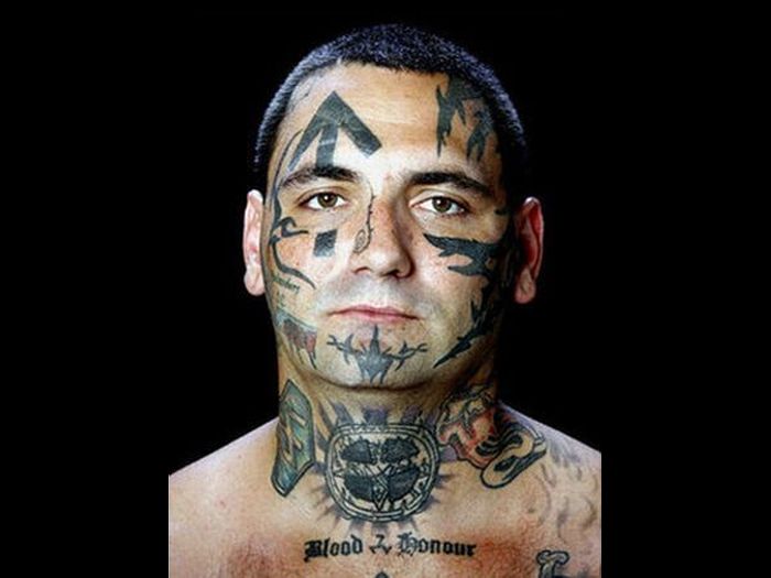 Брайон Виднер, удаление нео-нацистских татуировок с лица (12 фото) 