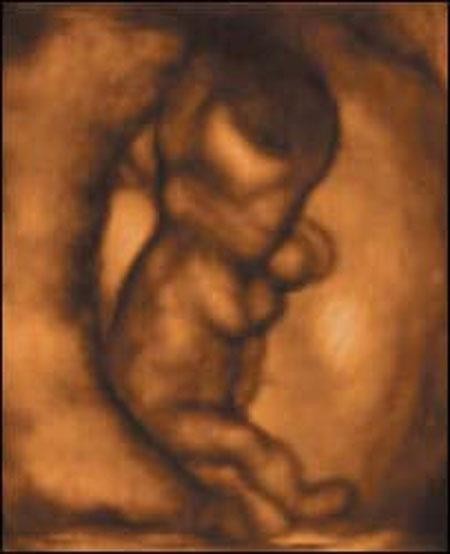 Фото эмбрион человека 12 недель фото