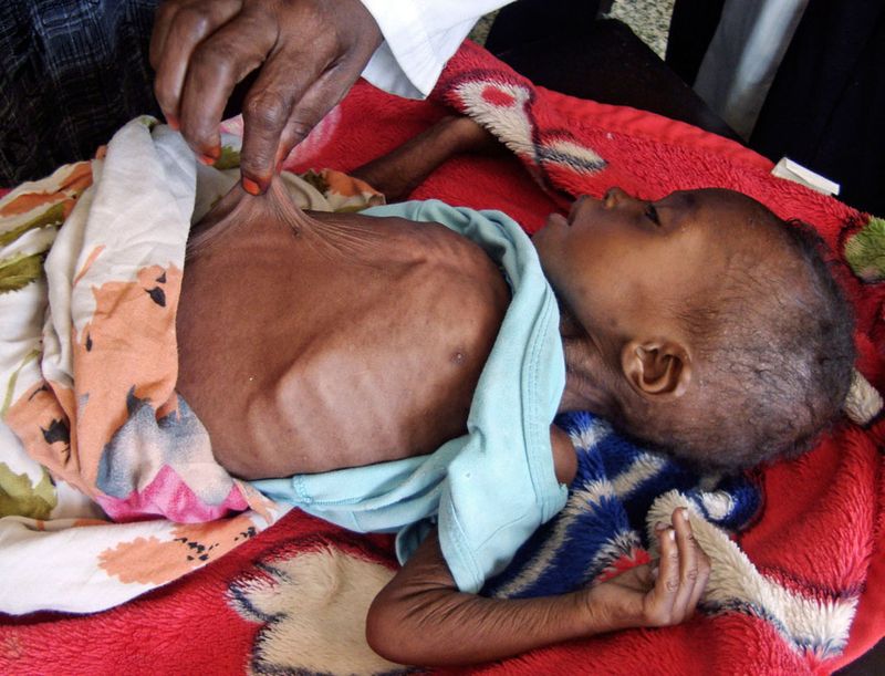 hungymamafrika21 Голод в Восточной Африке